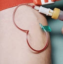 Proses Menderma Darah 
